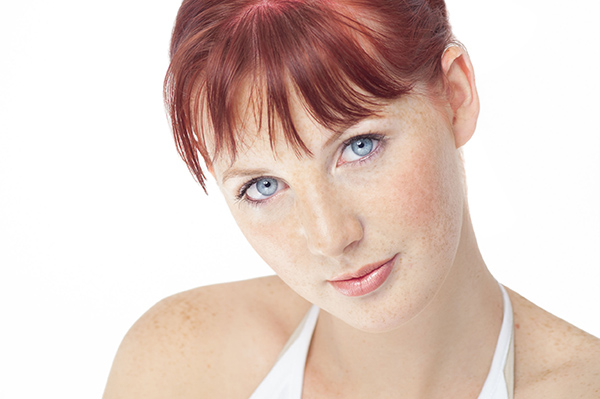 Causes of hyperpigmentation