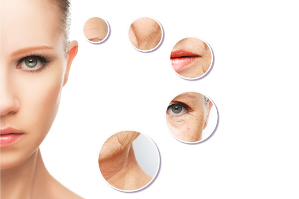 What causes wrinkles?